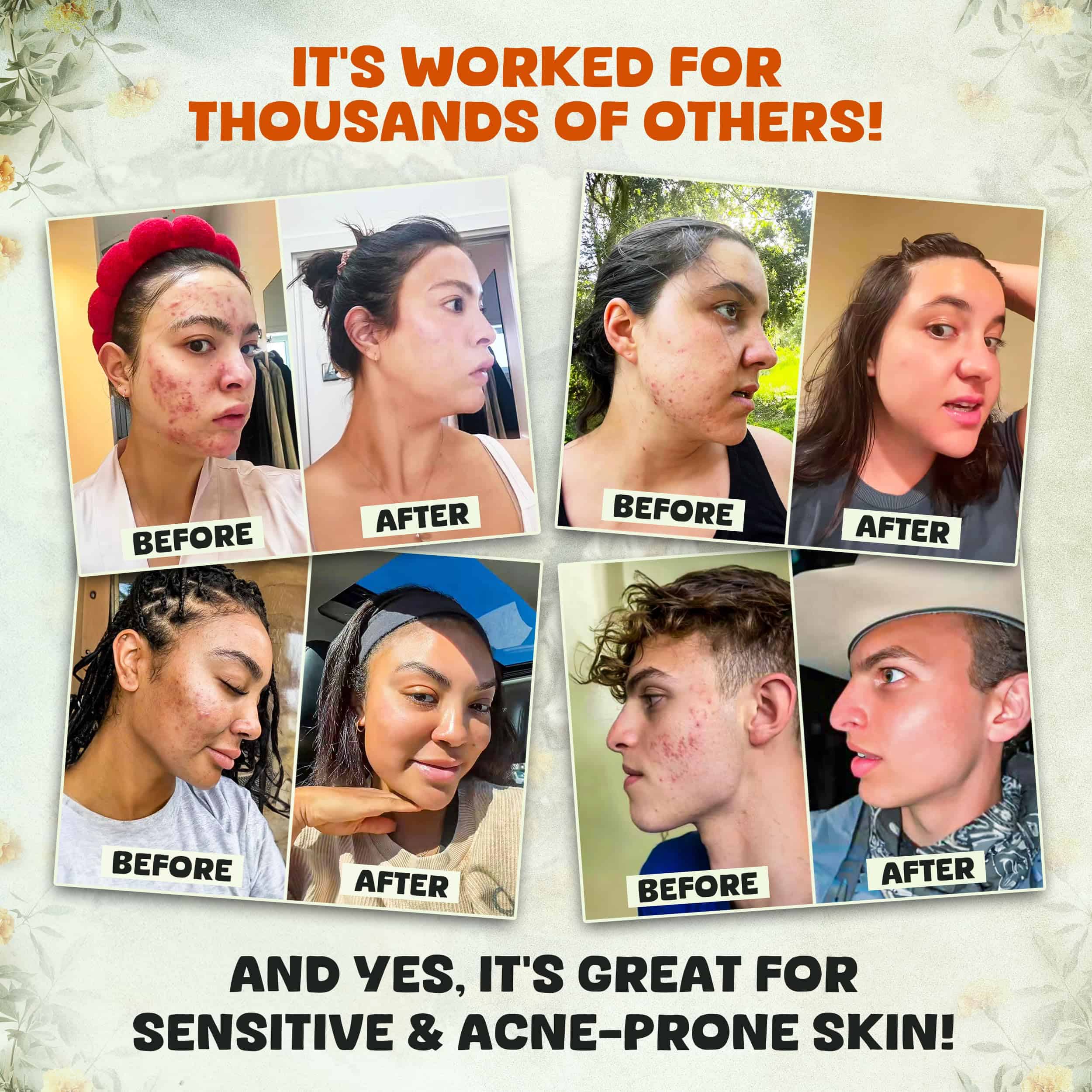 Bálsamo Hidratante de Tallow de Res y Miel de Manuka para - Imagen 4