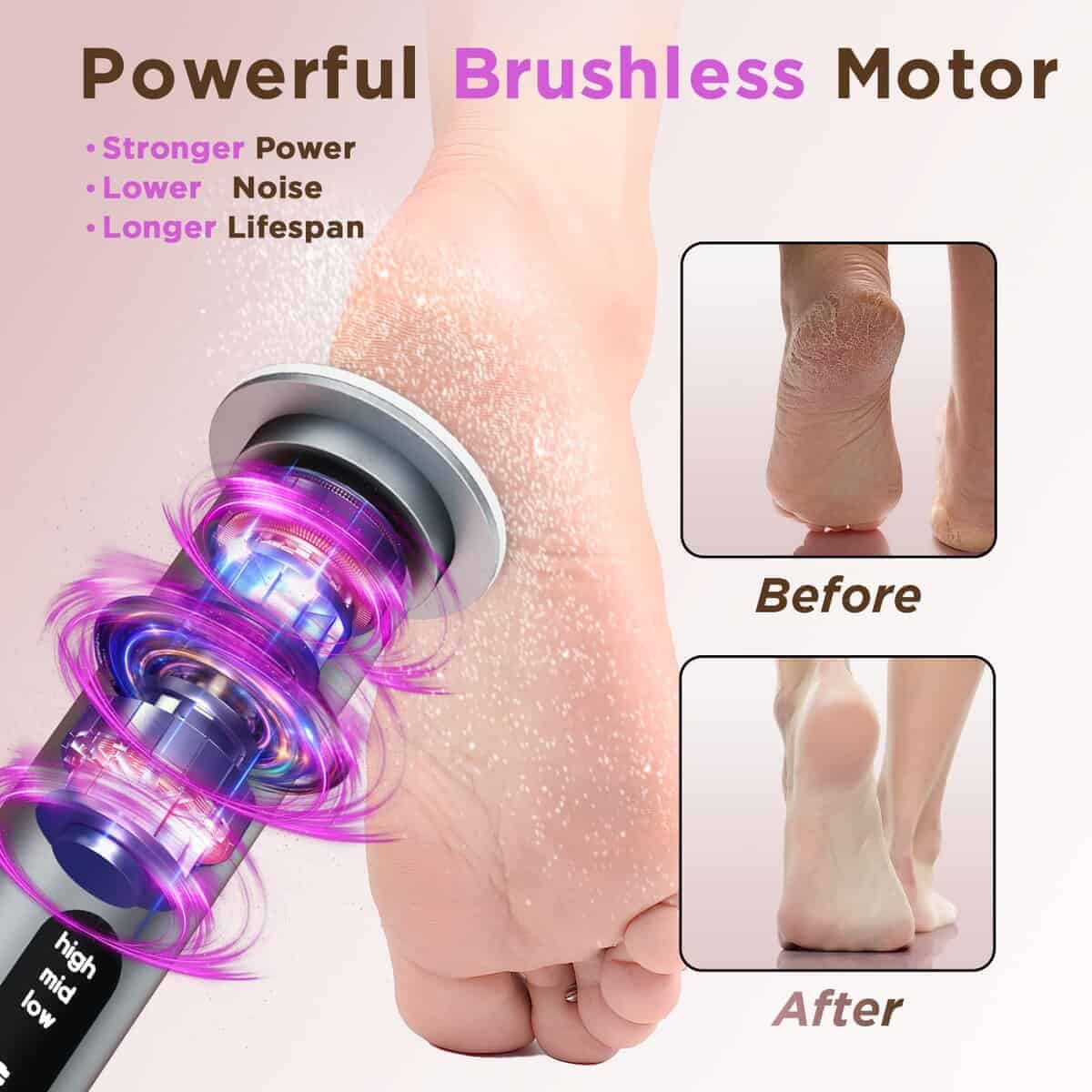 Eliminador de callos eléctrico para pies, motor sin - Imagen 3