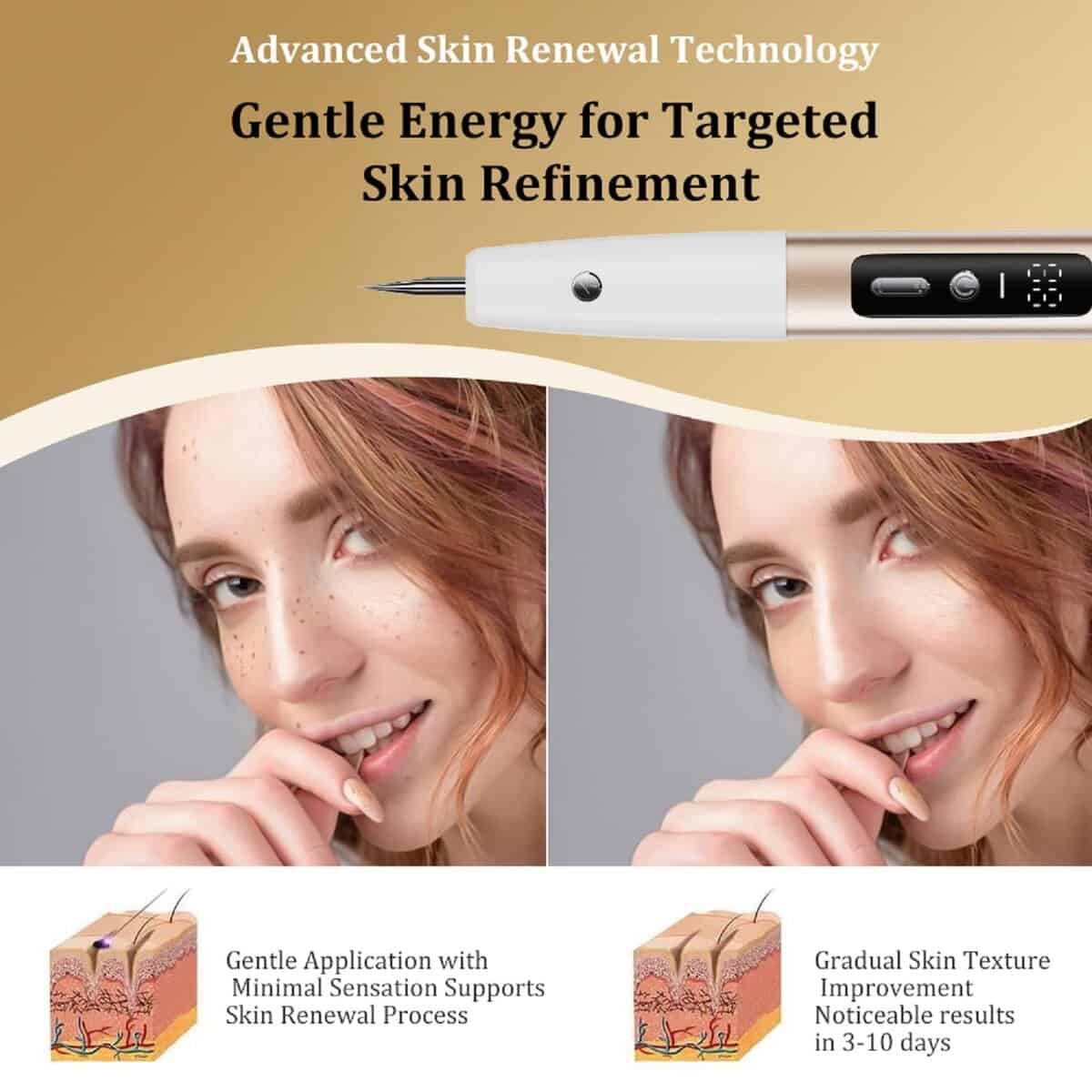 Herramienta de Mantenimiento Suave Para la Superficie de la - Imagen 4