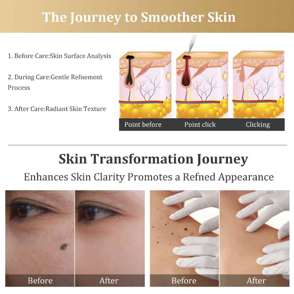 Herramienta de Mantenimiento Suave Para la Superficie de la - Imagen 7