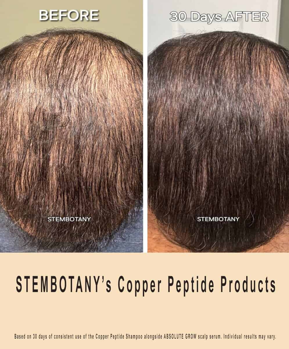 Champú de Péptido de Cobre STEM BOTANY para Hombres y - Imagen 6