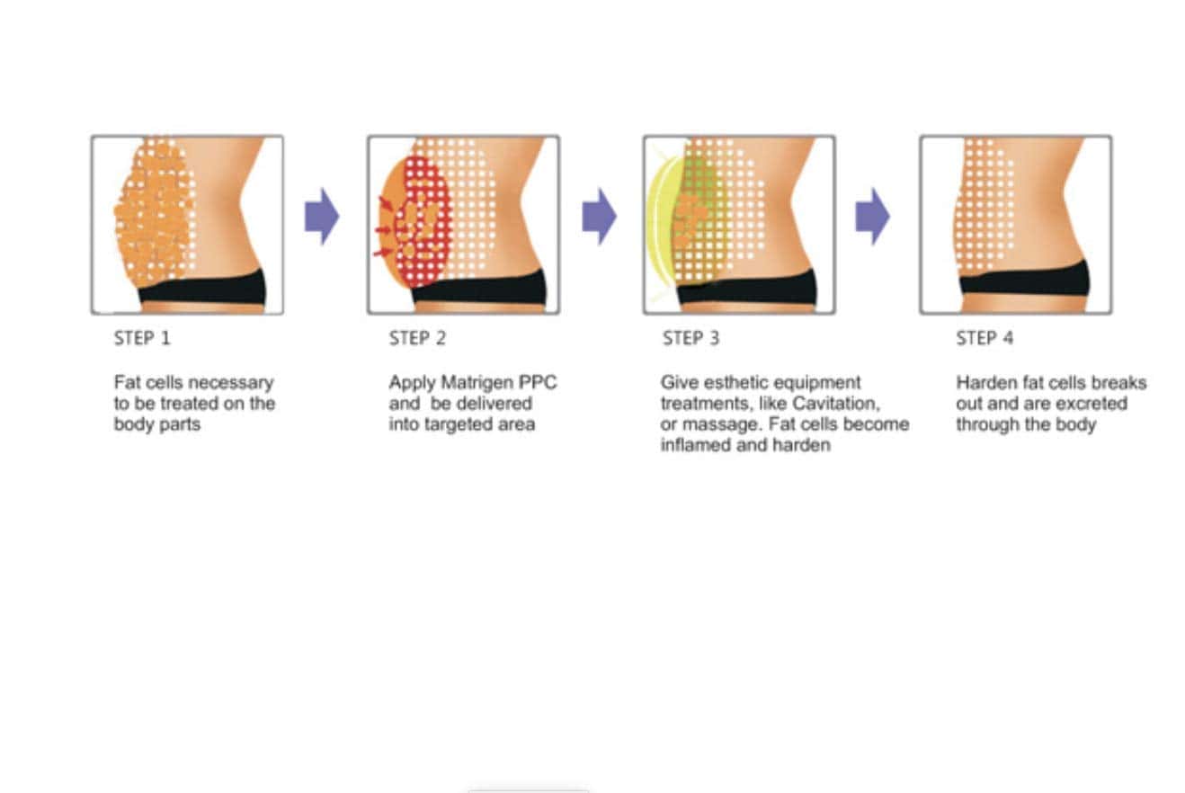 Línea de Cuerpo Efectiva Matrigen PPC Solution - Imagen 3
